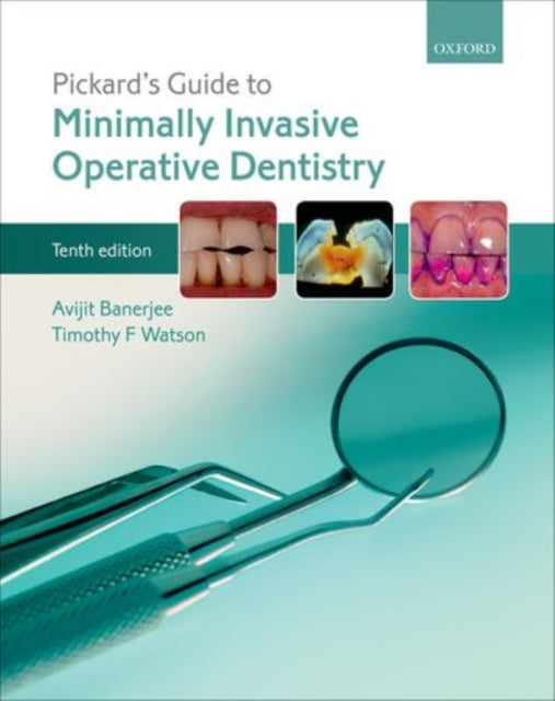 Book cover of: Pickard's Guide to Minimally Invasive Operative Dentistry. By: Avit Banerjee