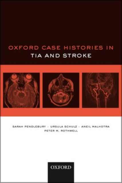Book cover of: Oxford Case Histories in TIA and Stroke