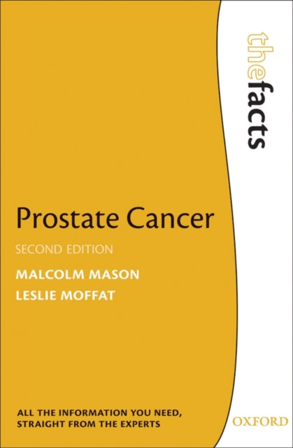 Book cover of: Prostate Cancer. By: Malcolm Mason