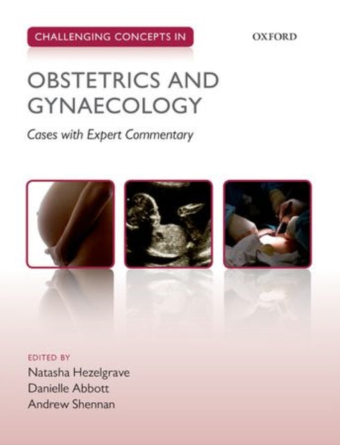 Book cover of: Challenging Concepts in Obstetrics and Gynaecology. By: Natasha Hezelgrave