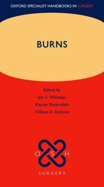 Book cover of: Burns. By: Iain S. Whitaker