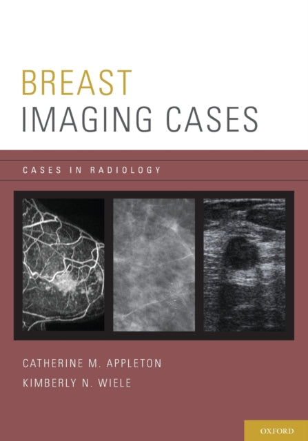 Book cover of: Breast Imaging Cases. By: Catherine M. Appleton