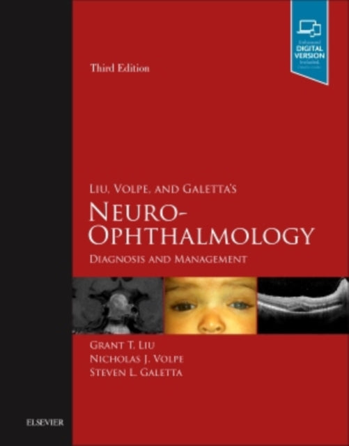 Book cover of: Liu, Volpe, and Galetta's Neuro-Ophthalmology. By: Grant T. Liu