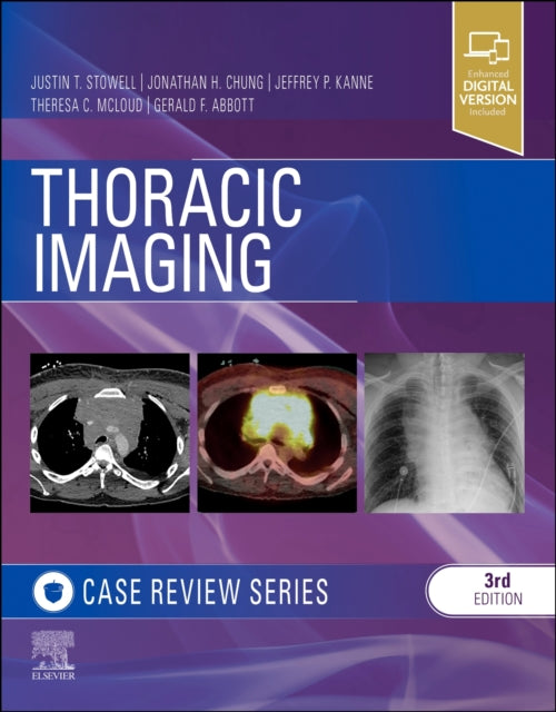 Book cover of: Thoracic Imaging: Case Review. By: Gerald F. Abbott