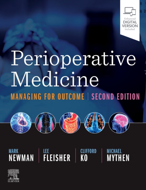 Book cover of: Perioperative Medicine. By: Mark F. Newman
