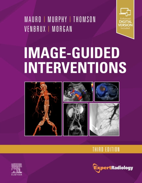 Book cover of: Image-Guided Interventions. By: Matthew A. Mauro