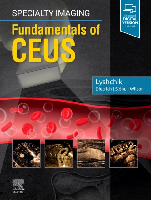 Book cover of: Specialty Imaging: Fundamentals of CEUS. By: Andrej Lyshchik