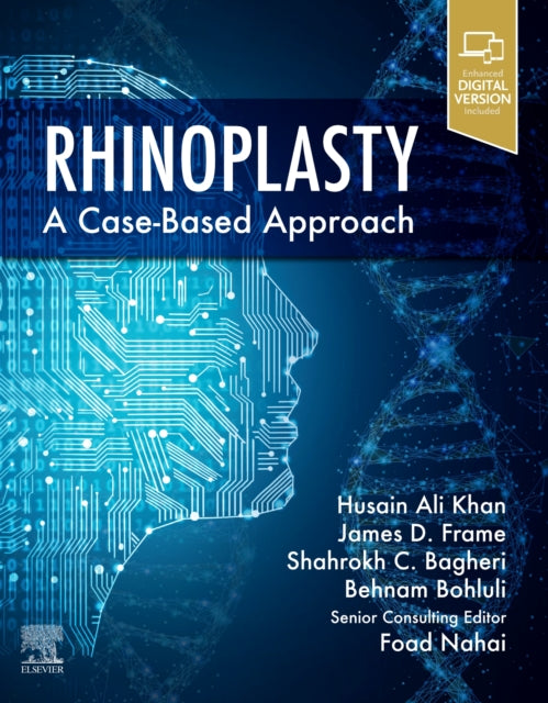 Book cover of: Rhinoplasty. By: Husain Ali Khan