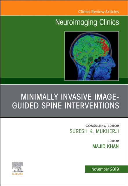 Book cover of: Spine Intervention, An Issue of Neuroimaging Clinics of North America. By: Majid Khan