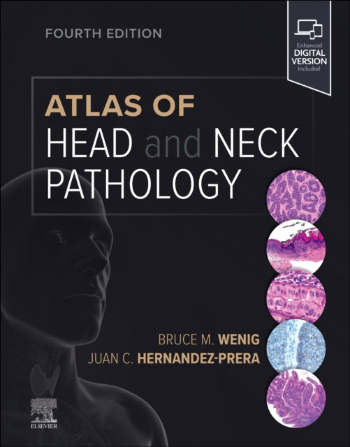 Book cover of: Atlas of Head and Neck Pathology. By: Bruce M. Wenig