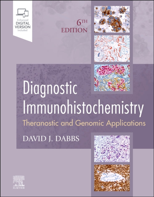 Book cover of: Diagnostic Immunohistochemistry. By: David J. Dabbs