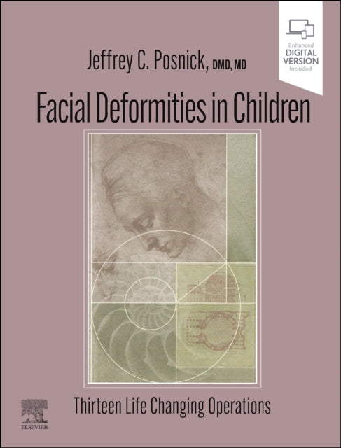 Book cover of: Facial Deformities in Children. By: Jeffrey C. Posnick