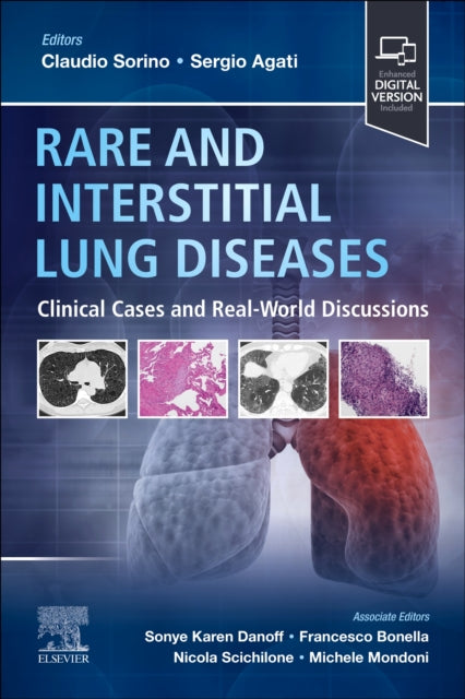 Book cover of: Rare and Interstitial Lung Diseases. By: Claudio Sorino