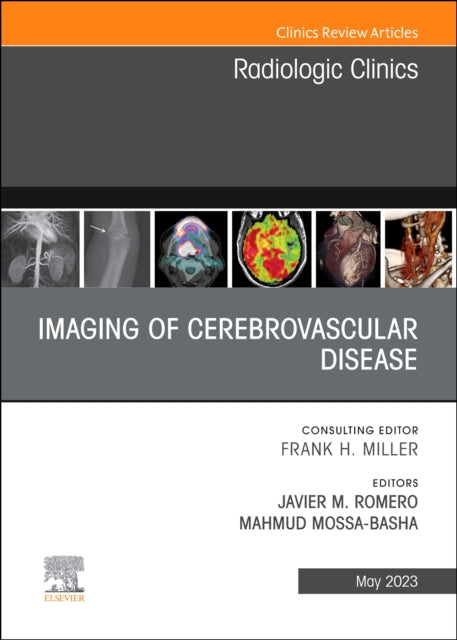 Book cover of: Imaging of Cerebrovascular Disease, An Issue of Radiologic Clinics of North America. By: Javier M. Romero