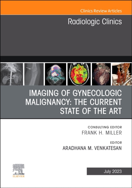 Book cover of: Imaging of Gynecologic Malignancy: The Current State of the Art, An Issue of Radiologic Clinics of North America. By: Aradhana M. Venkatesan