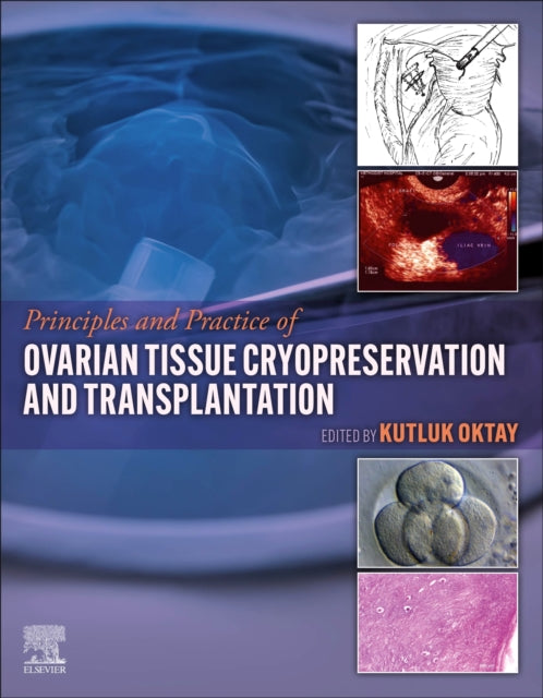 Book cover of: Principles and Practice of Ovarian Tissue Cryopreservation and Transplantation. By: Kutluk Oktay