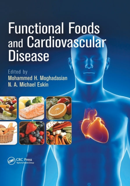 Book cover of: Functional Foods and Cardiovascular Disease. By: Mohammed H. Moghadasian