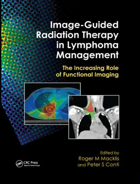 Book cover of: Image-Guided Radiation Therapy in Lymphoma Management. By: Roger M. Macklis