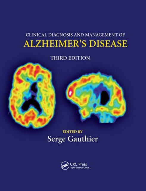 Book cover of: Clinical Diagnosis and Management of Alzheimer's Disease. By: Serge Gauthier