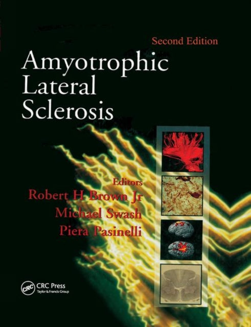 Book cover of: Amyotrophic Lateral Sclerosis, Second Edition. By: Robert H. Brown