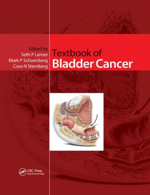 Book cover of: Textbook of Bladder Cancer. By: Seth P. Lerner
