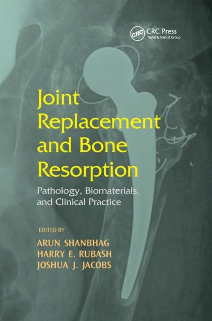 Book cover of: Joint Replacement and Bone Resorption. By: Arun Shanbhag