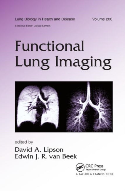 Book cover of: Functional Lung Imaging. By: David Lipson