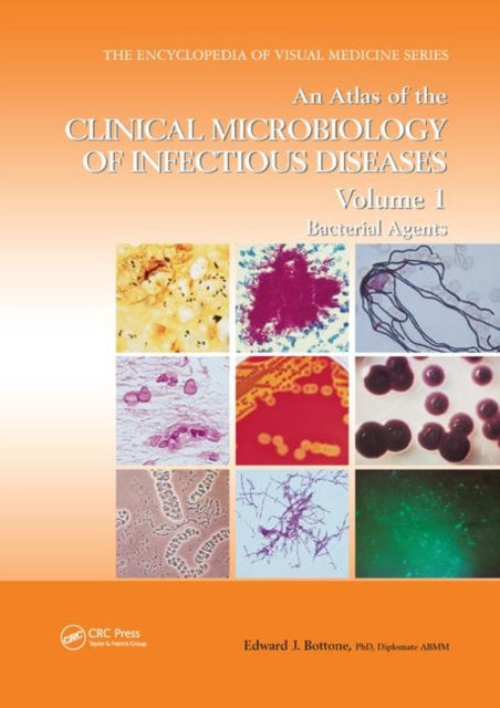 Book cover of: Atlas of the Clinical Microbiology of Infectious Diseases, Volume 1. By: Edward J. Bottone
