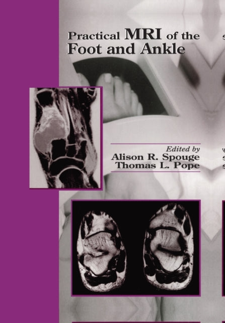 Book cover of: Practical MRI of the Foot and Ankle. By: Alison R. Spouge