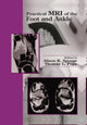 Book cover of: Practical MRI of the Foot and Ankle. By: Alison R. Spouge