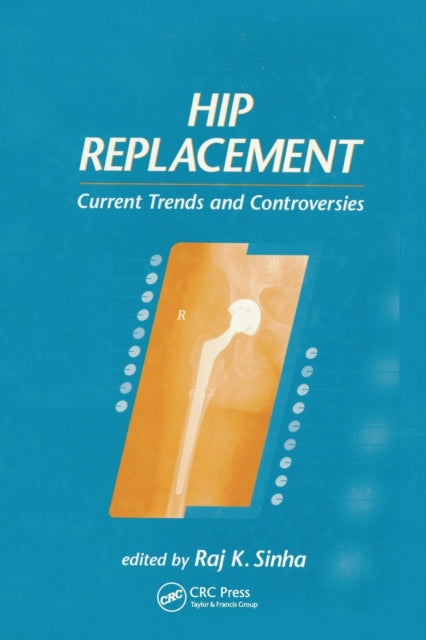 Book cover of: Hip Replacement. By: Raj K. Sinha