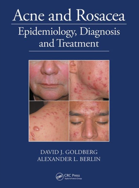Book cover of: Acne and Rosacea. By: David Goldberg