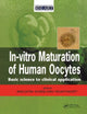 Book cover of: In Vitro Maturation of Human Oocytes