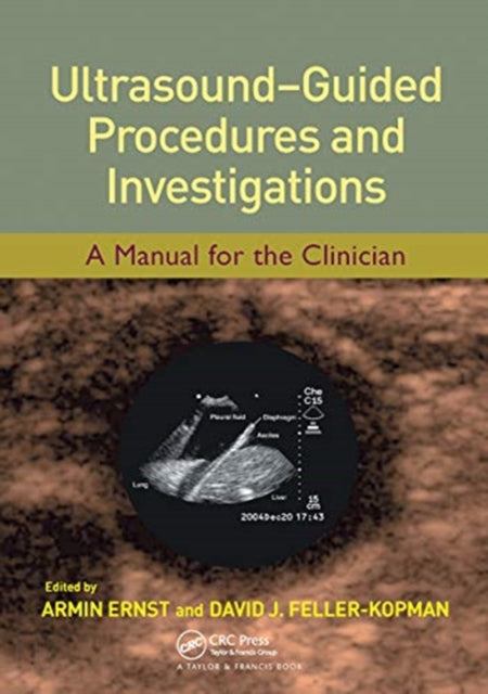 Book cover of: Ultrasound-Guided Procedures and Investigations. By: Armin Ernst