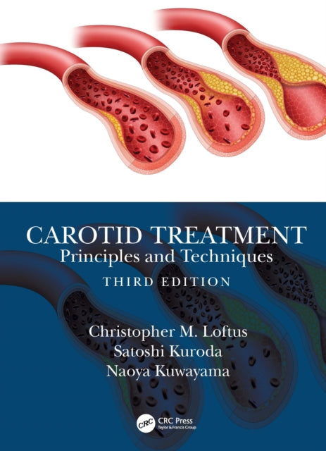 Book cover of: Carotid Treatment: Principles and Techniques. By: Christopher M. Loftus