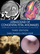 Book cover of: Ultrasound of Congenital Fetal Anomalies. By: Dario Paladini