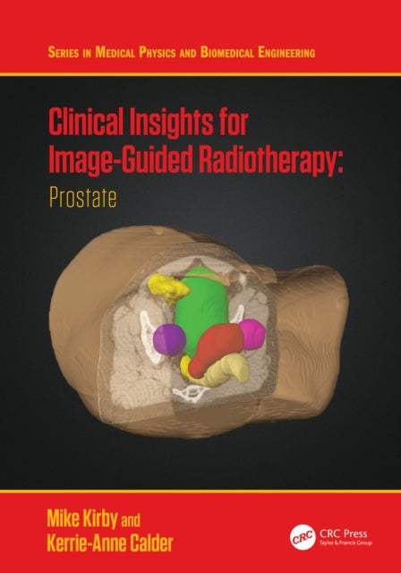 Book cover of: Clinical Insights for Image-Guided Radiotherapy. By: Mike Kirby