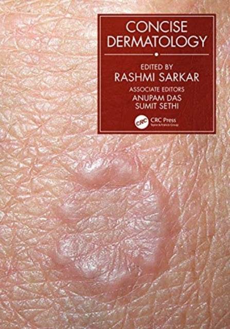 Book cover of: Concise Dermatology. By: Rashmi Sarkar