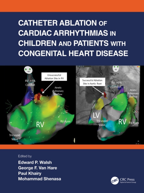 Book cover of: Catheter Ablation of Cardiac Arrhythmias in Children and Patients with Congenital Heart Disease. By: Edward P. Walsh