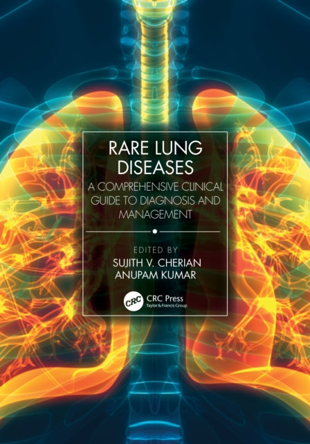 Book cover of: Rare Lung Diseases. By: Sujith V. Cherian