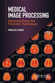 Book cover of: Medical Image Processing. By: Tamalika Chaira