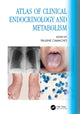 Book cover of: Atlas of Clinical Endocrinology and Metabolism. By: Pauline Camacho