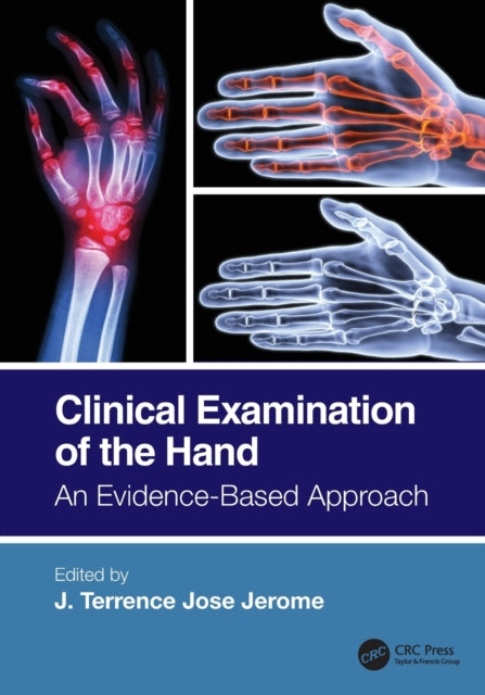 Book cover of: Clinical Examination of the Hand. By: J. Terrence Jose Jerome