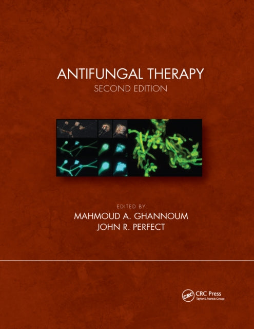 Book cover of: Antifungal Therapy, Second Edition. By: Mahmoud A. Ghannoum