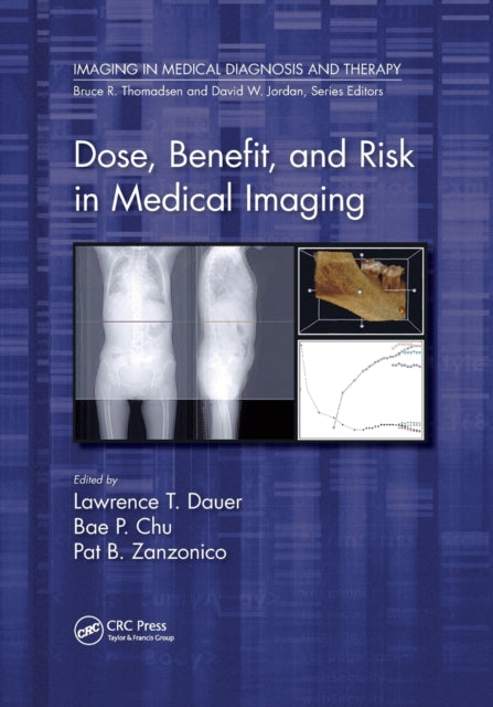Book cover of: Dose, Benefit, and Risk in Medical Imaging. By: Lawrence Dauer