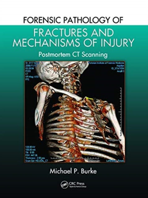 Book cover of: Forensic Pathology of Fractures and Mechanisms of Injury. By: Michael P. Burke