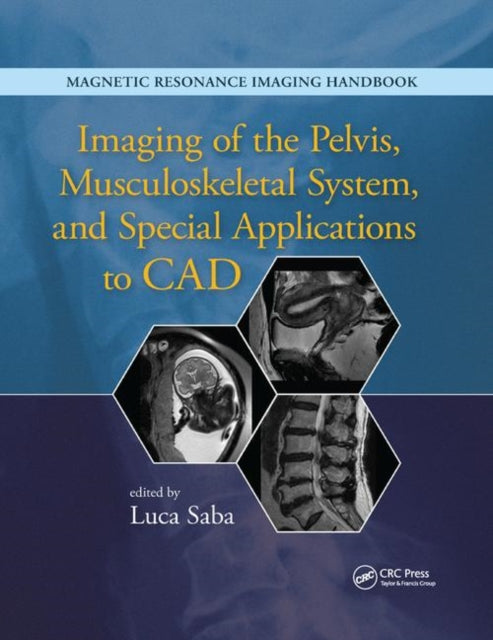 Book cover of: Imaging of the Pelvis, Musculoskeletal System, and Special Applications to CAD. By: Luca Saba
