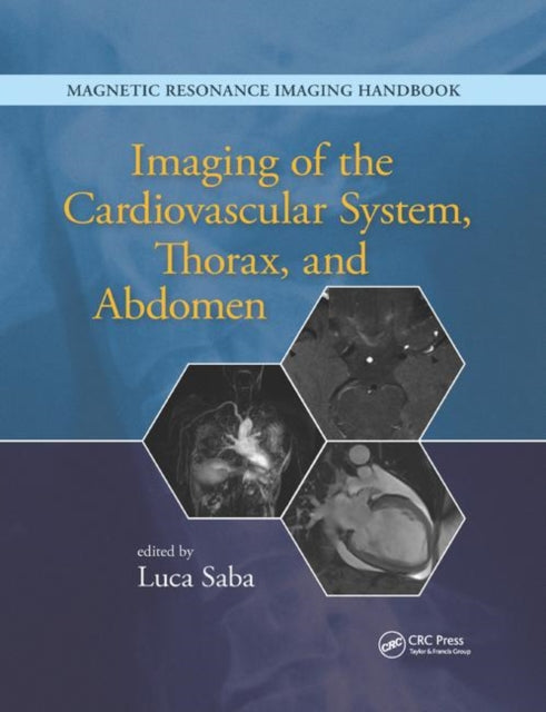 Book cover of: Imaging of the Cardiovascular System, Thorax, and Abdomen. By: Luca Saba