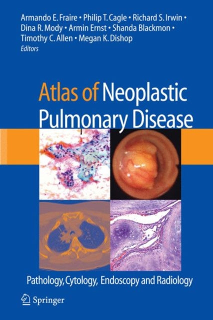 Book cover of: Atlas of Neoplastic Pulmonary Disease. By: Armando E. Fraire