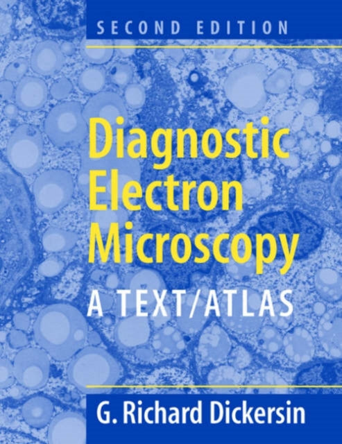 Book cover of: Diagnostic Electron Microscopy. By: Richard G. Dickersin